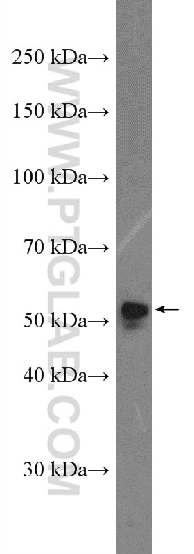Western Blot (WB) analysis of A431 cells using NAP1L4 Polyclonal antibody (16018-1-AP)