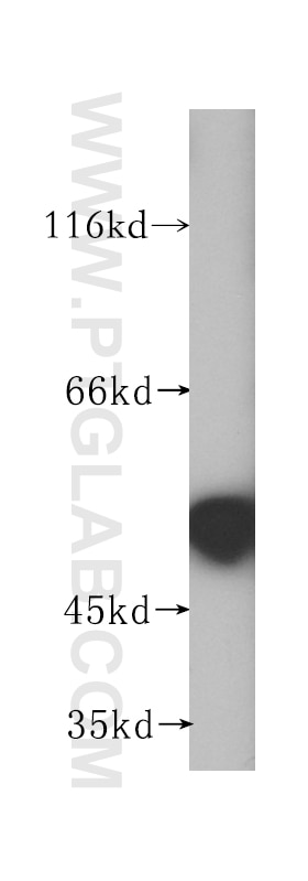 Western Blot (WB) analysis of mouse testis tissue using NAP1L4 Polyclonal antibody (16018-1-AP)
