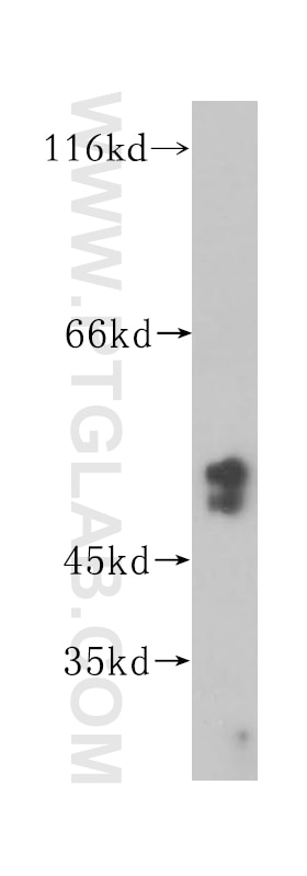 Western Blot (WB) analysis of HEK-293 cells using NAP1L4 Polyclonal antibody (16018-1-AP)