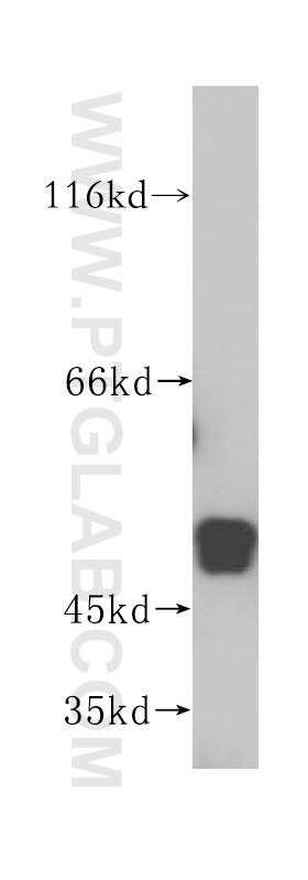 Western Blot (WB) analysis of HeLa cells using NAP1L4 Polyclonal antibody (16018-1-AP)