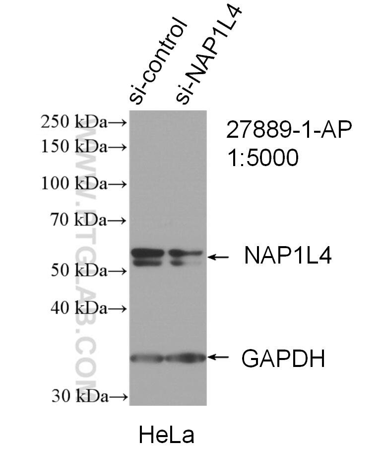 Western Blot (WB) analysis of HeLa cells using NAP1L4 Polyclonal antibody (27889-1-AP)