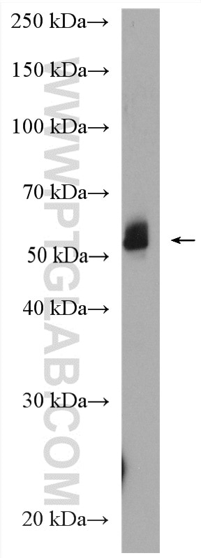 WB analysis of human testis using 27889-1-AP