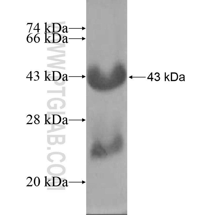 NAP1L5 fusion protein Ag12876 SDS-PAGE NAP1L5 fusion protein Ag12876 SDS-PAGE