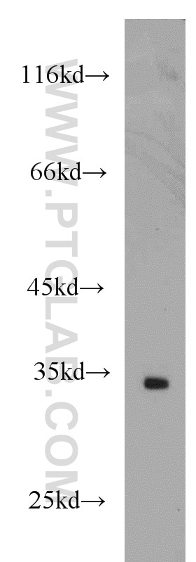 Western Blot (WB) analysis of mouse brain tissue using Alpha SNAP Polyclonal antibody (10184-1-AP)