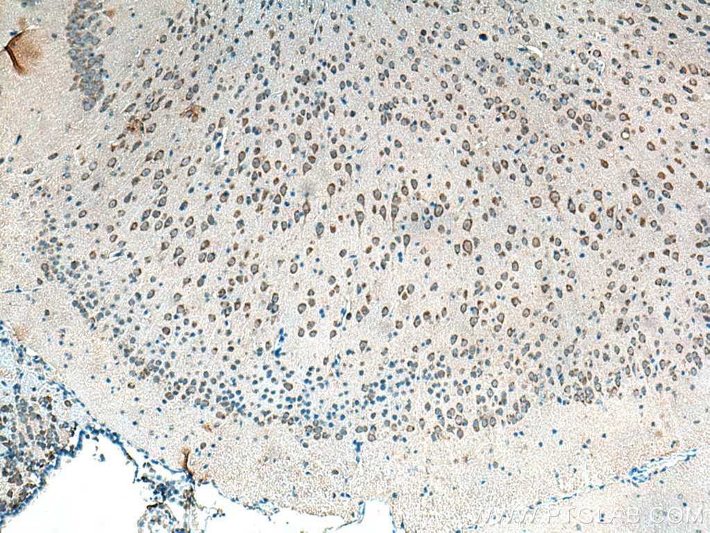 Immunohistochemistry (IHC) staining of mouse brain tissue using Alpha SNAP Polyclonal antibody (10546-1-AP)