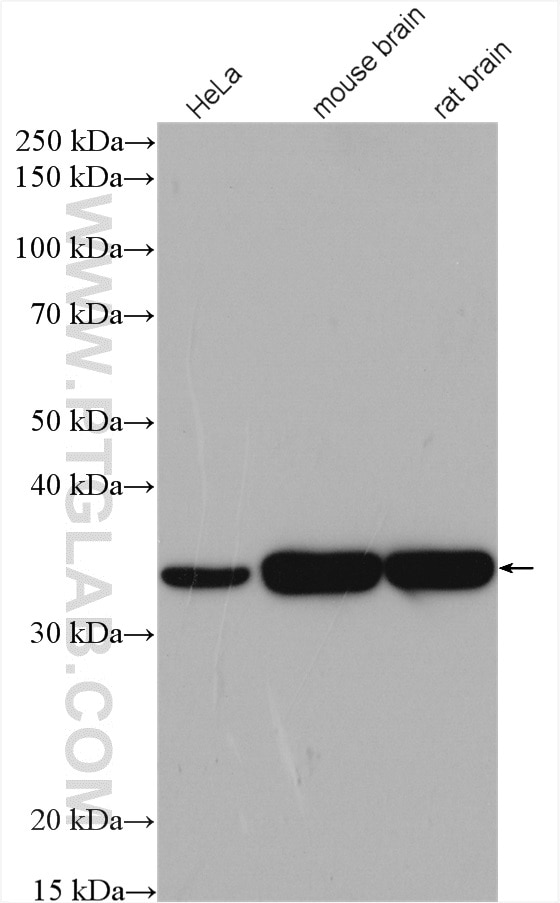 Western Blot (WB) analysis of various lysates using Alpha SNAP Polyclonal antibody (10546-1-AP)