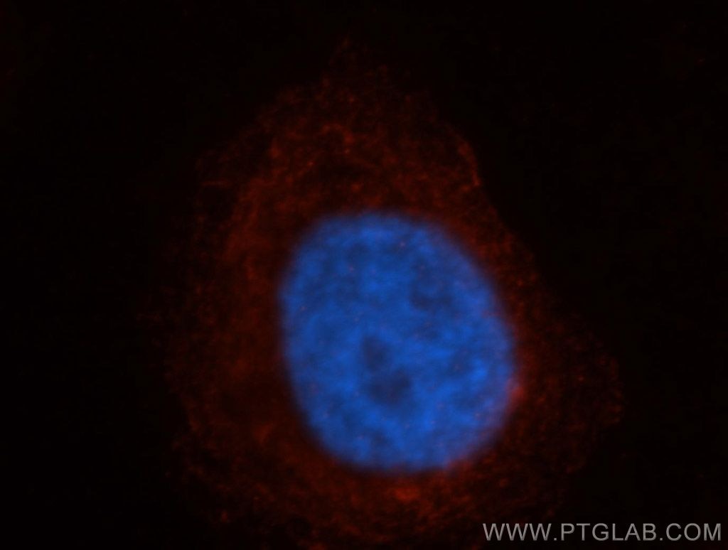 Immunofluorescence (IF) / fluorescent staining of HepG2 cells using NAPB Polyclonal antibody (14106-1-AP)