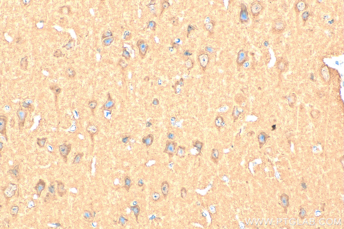 IHC staining of mouse brain using 14106-1-AP