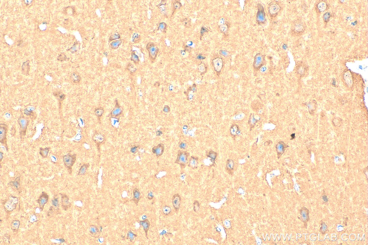Immunohistochemistry (IHC) staining of mouse brain tissue using NAPB Polyclonal antibody (14106-1-AP)