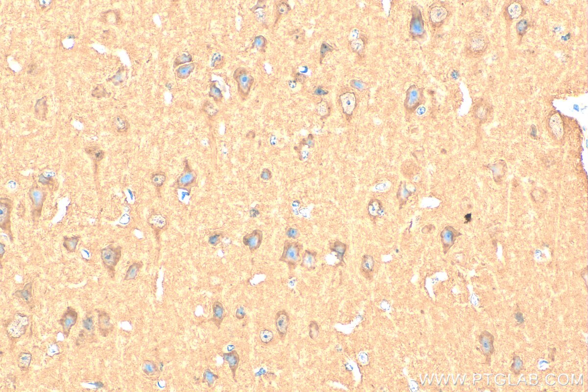 IHC staining of mouse brain using 14106-1-AP