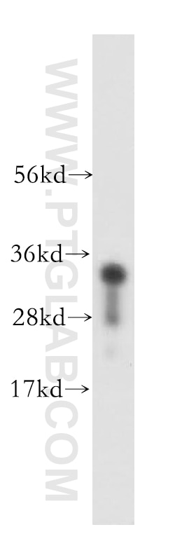 Western Blot (WB) analysis of mouse brain tissue using NAPB Polyclonal antibody (14106-1-AP)