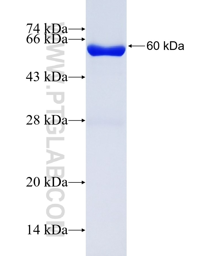 NAPB fusion protein Ag5239 SDS-PAGE