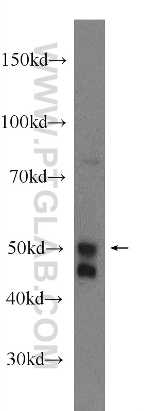 Western Blot (WB) analysis of HEK-293 cells using NAPRT1 Polyclonal antibody (13549-1-AP)