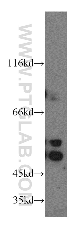 WB analysis of HEK-293 using 13549-1-AP