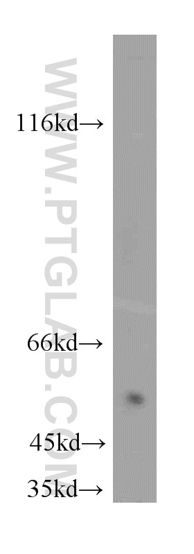 Western Blot (WB) analysis of human small intestine tissue using NAPRT1 Polyclonal antibody (13549-1-AP)