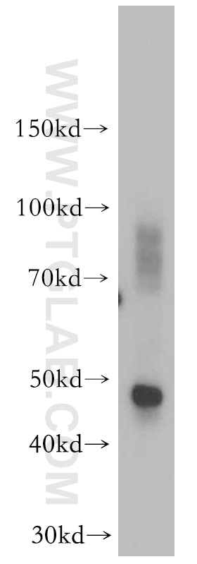 Western Blot (WB) analysis of mouse kidney tissue using NAPRT1 Polyclonal antibody (13549-1-AP)