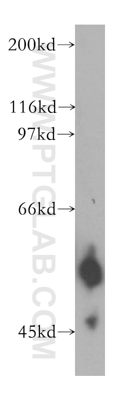 Western Blot (WB) analysis of human colon tissue using NAPRT1 Polyclonal antibody (13549-1-AP)