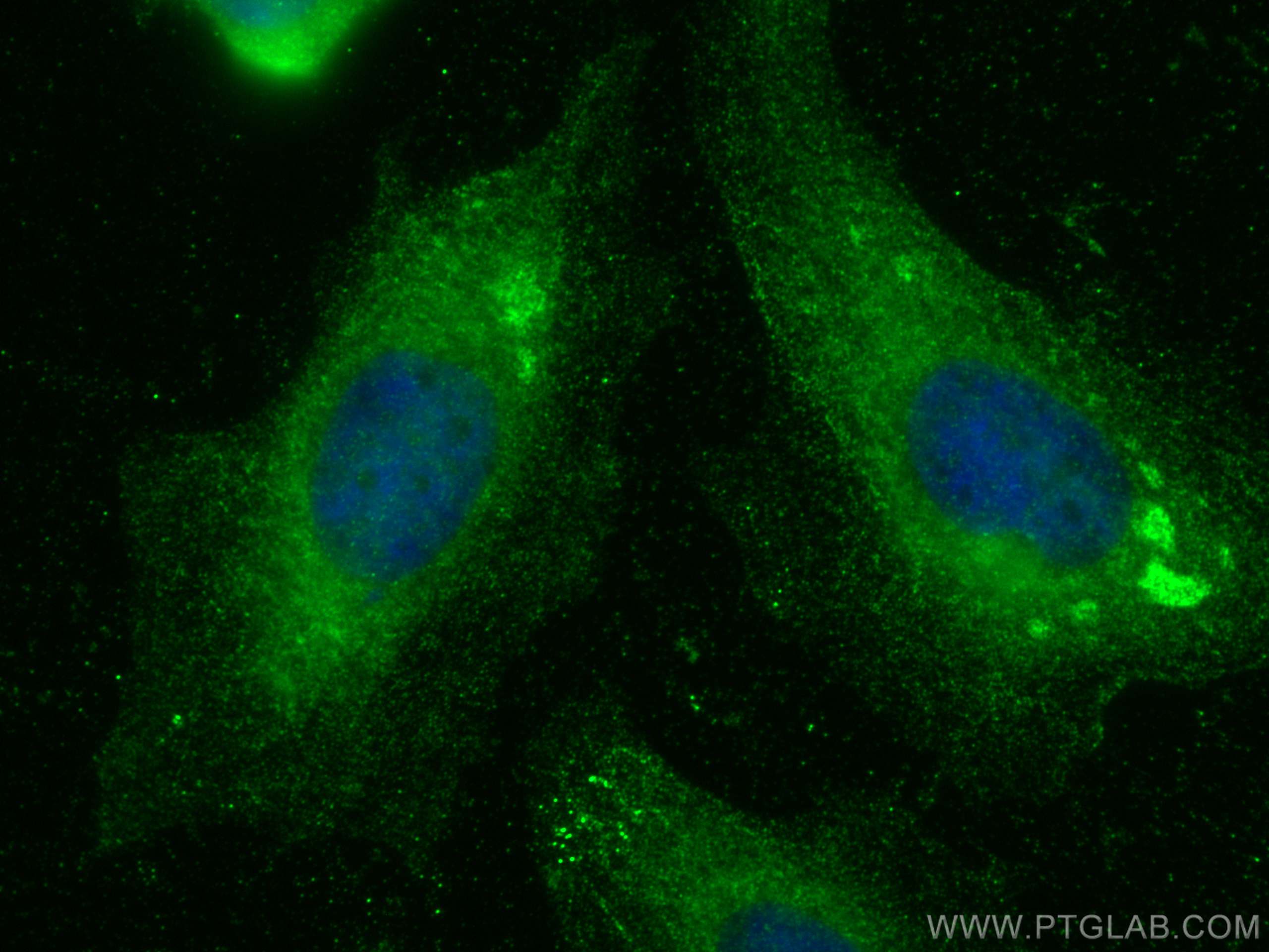 Immunofluorescence (IF) / fluorescent staining of HeLa cells using NAPRT1 Monoclonal antibody (66159-1-Ig)