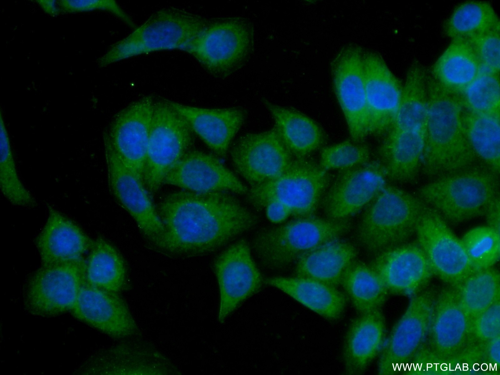 Immunofluorescence (IF) / fluorescent staining of HeLa cells using NAPRT1 Monoclonal antibody (66159-1-Ig)