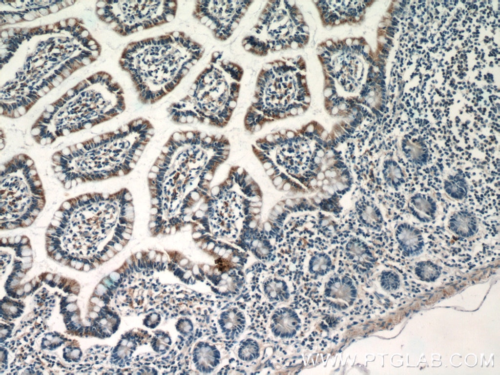 Immunohistochemistry (IHC) staining of human small intestine tissue using NAPRT1 Monoclonal antibody (66159-1-Ig)