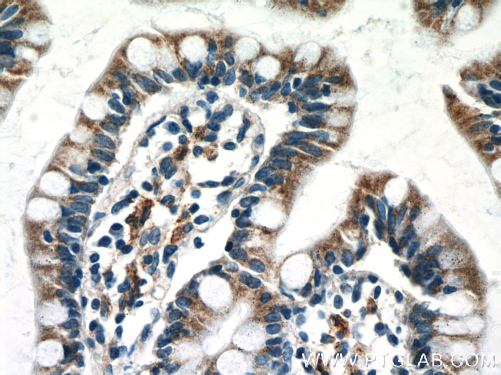 Immunohistochemistry (IHC) staining of human small intestine tissue using NAPRT1 Monoclonal antibody (66159-1-Ig)