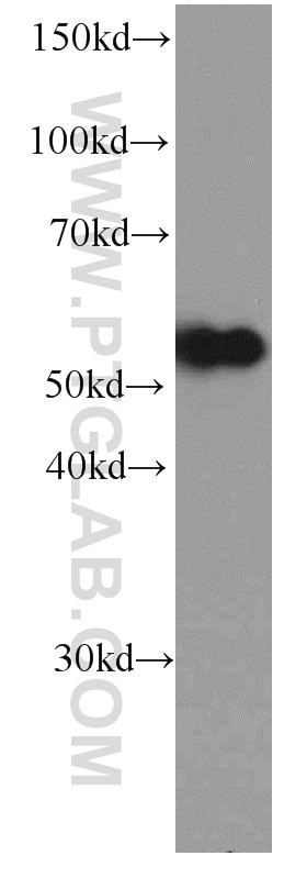 Western Blot (WB) analysis of HEK-293 cells using NAPRT1 Monoclonal antibody (66159-1-Ig)