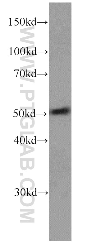 Western Blot (WB) analysis of HepG2 cells using NAPRT1 Monoclonal antibody (66159-1-Ig)