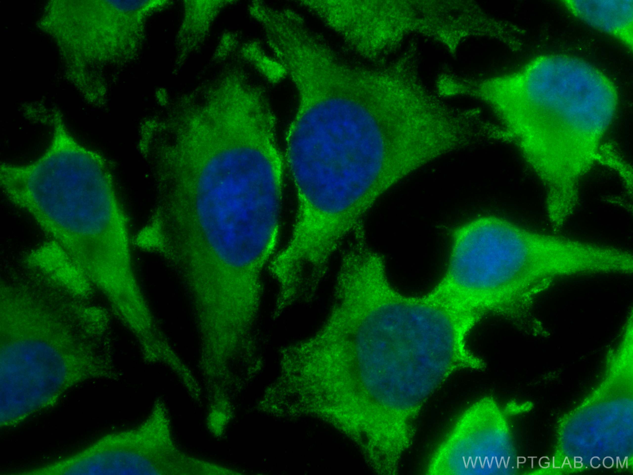 Immunofluorescence (IF) / fluorescent staining of HeLa cells using CoraLite® Plus 488-conjugated NAPRT1 Monoclonal an (CL488-66159)