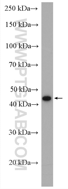 WB analysis of mouse lung using 16558-1-AP