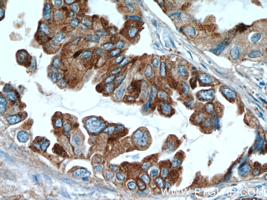 Napsin A Monoclonal antibody