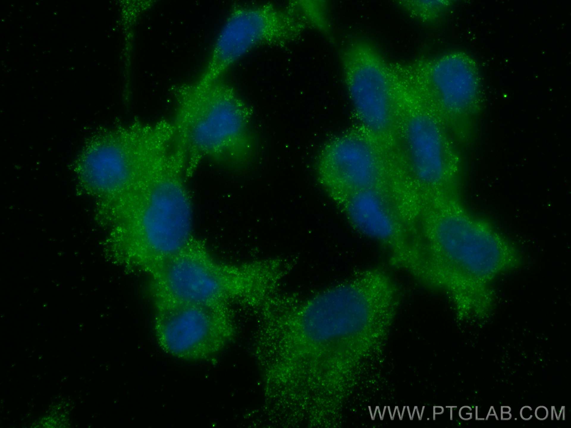 Immunofluorescence (IF) / fluorescent staining of HUVEC cells using Napsin A Monoclonal antibody (60259-2-Ig)