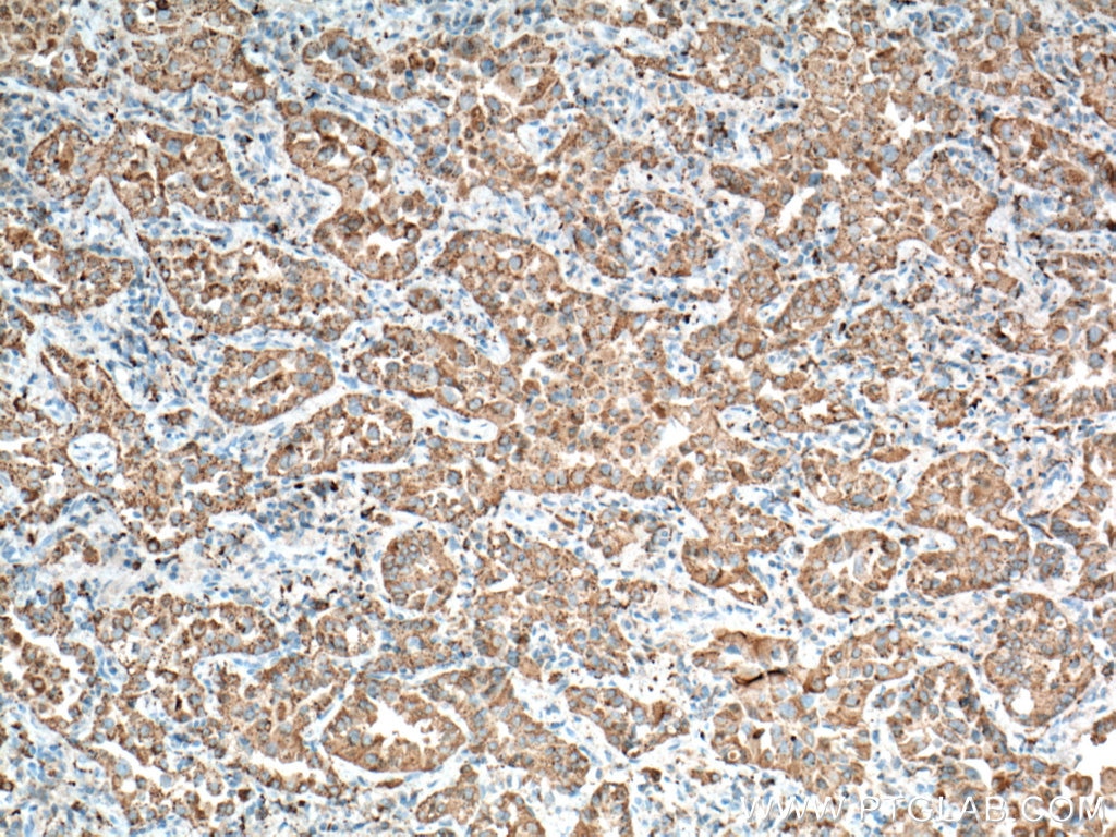 Napsin A antibody (60259-2-Ig) | Proteintech