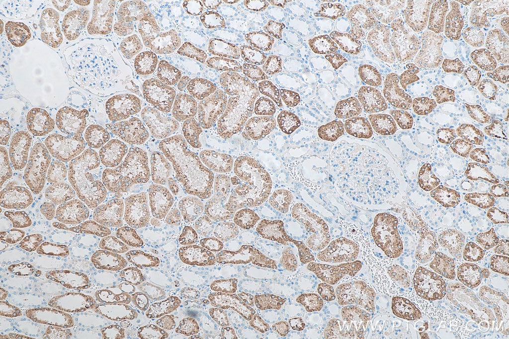 Immunohistochemistry (IHC) staining of human kidney tissue using Napsin A Monoclonal antibody (60259-2-Ig)