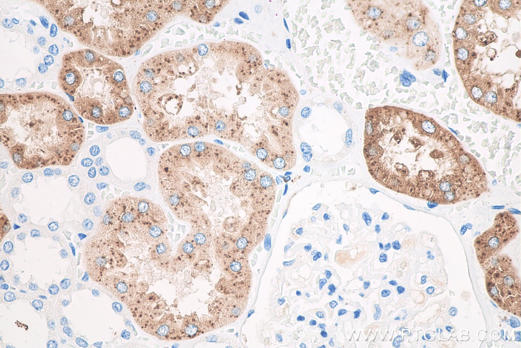 IHC staining of human kidney using 60259-2-Ig