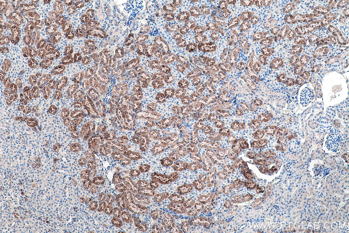 IHC staining of mouse kidney using 60259-2-Ig Immunohistochemistry (IHC) staining of mouse kidney tissue using Napsin A Monoclonal antibody (60259-2-Ig)