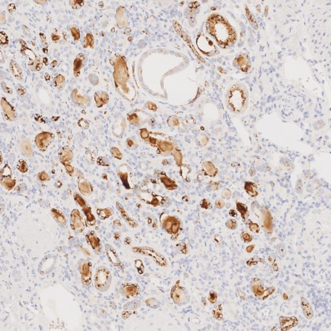 IHC staining of human kidney using 60259-2-Ig Immunohistochemistry (IHC) staining of human kidney tissue using Napsin A Monoclonal antibody (60259-2-Ig)
