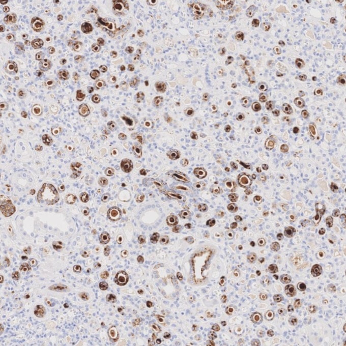 IHC staining of human kidney using 60259-2-Ig Immunohistochemistry (IHC) staining of human kidney tissue using Napsin A Monoclonal antibody (60259-2-Ig)