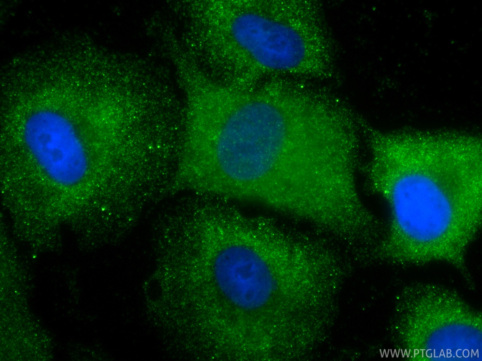 Immunofluorescence (IF) / fluorescent staining of A549 cells using Napsin A Recombinant monoclonal antibody (86052-4-RR)