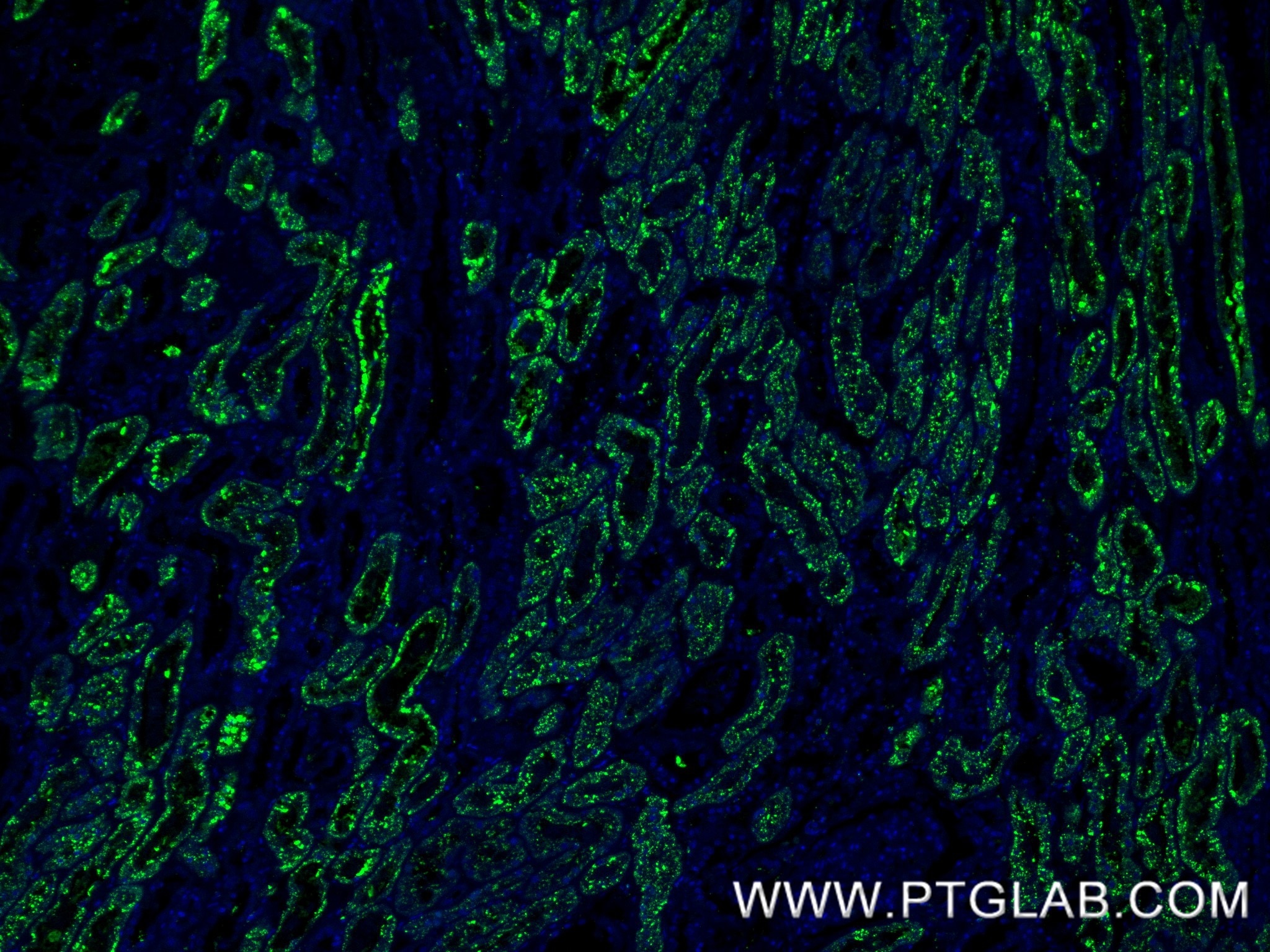Immunofluorescence (IF) / fluorescent staining of human kidney tissue using Napsin A Recombinant monoclonal antibody (86052-4-RR)