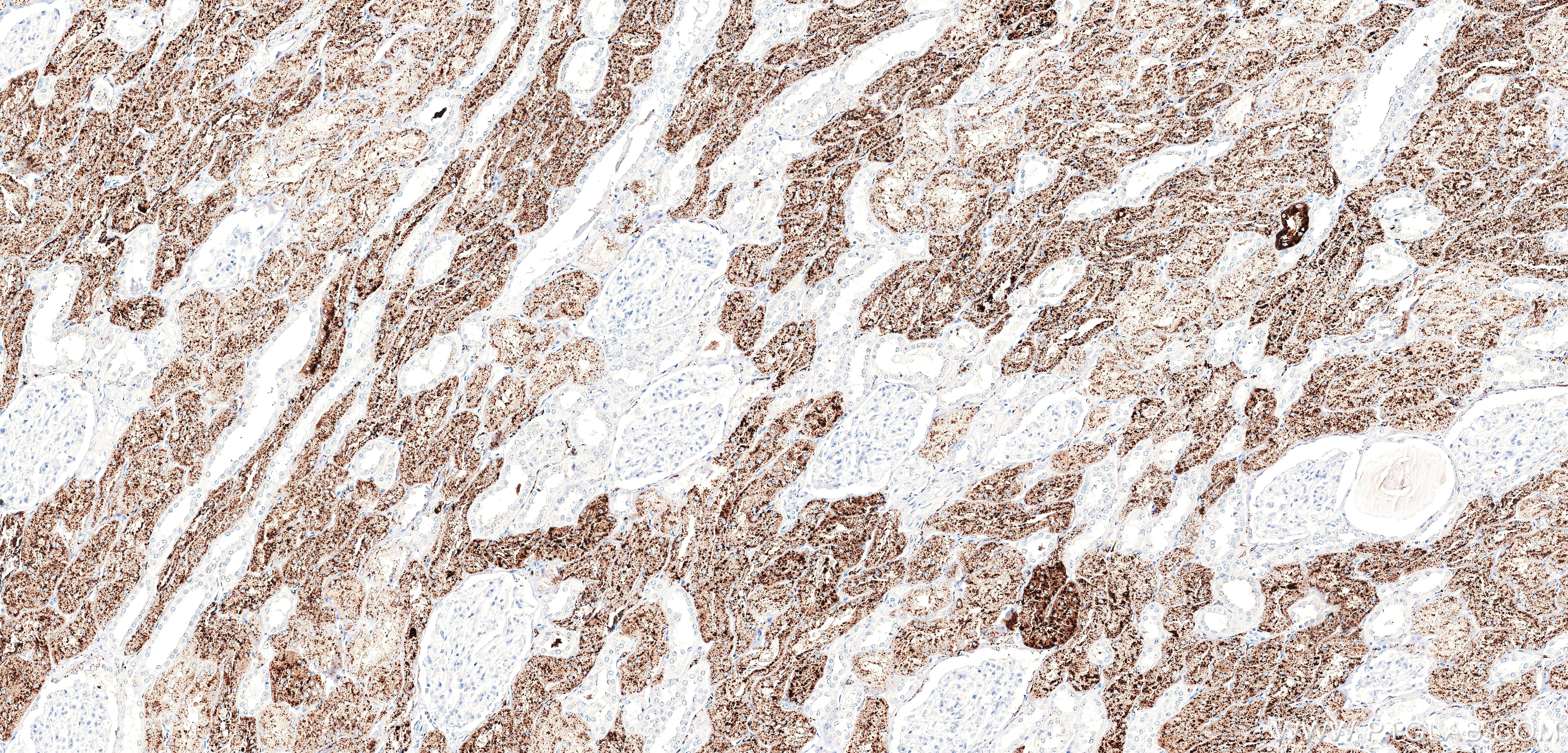 Immunohistochemistry (IHC) staining of human kidney tissue using Napsin A Recombinant monoclonal antibody (86052-4-RR)