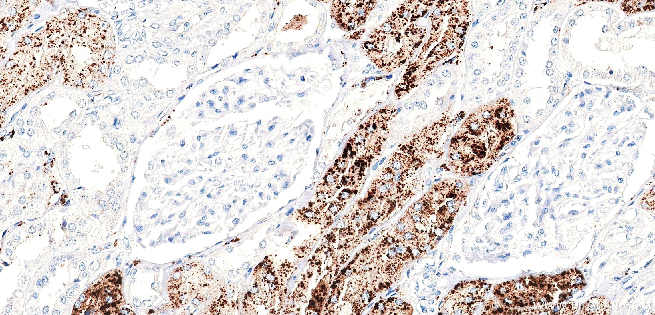 Immunohistochemistry (IHC) staining of human kidney tissue using Napsin A Recombinant monoclonal antibody (86052-4-RR)