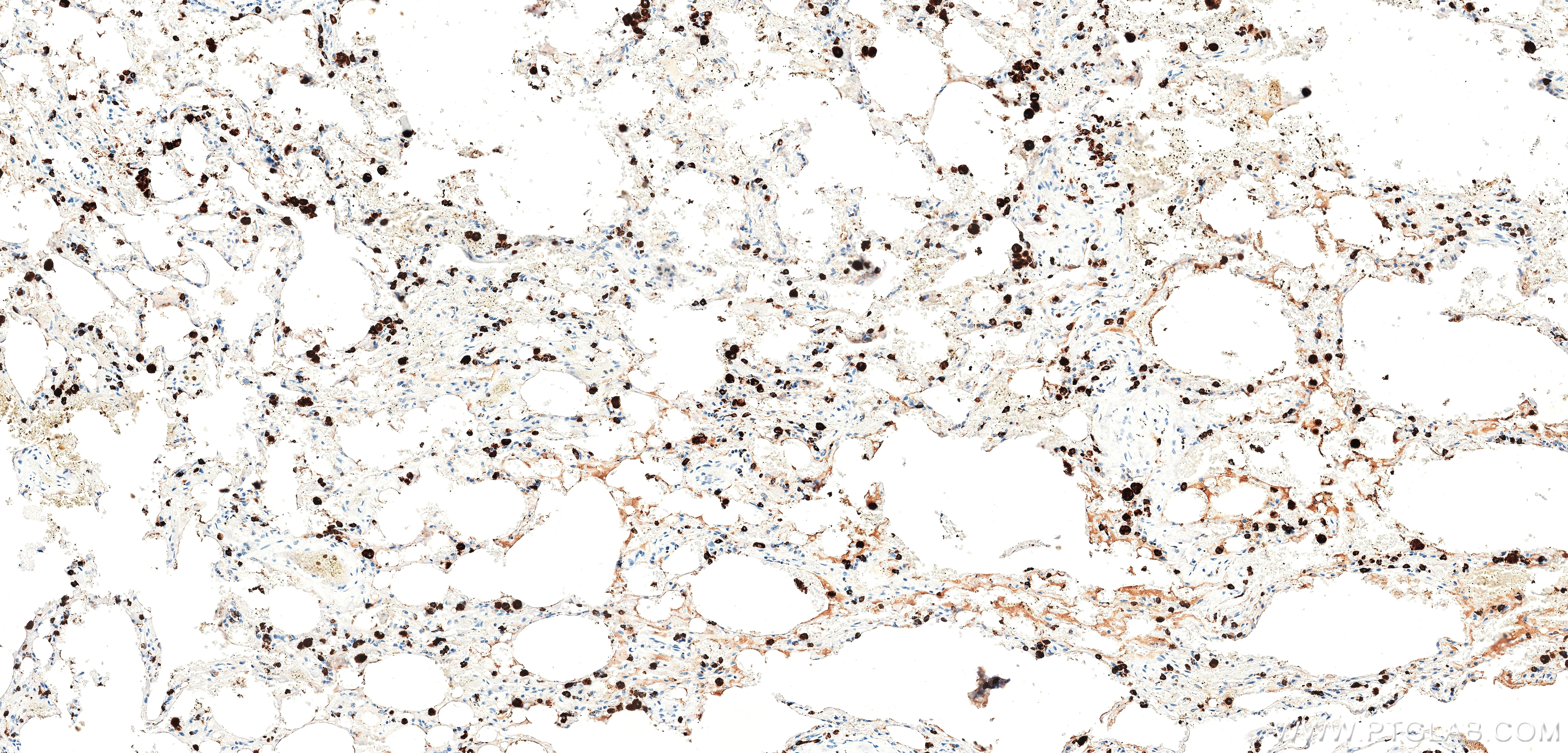 Immunohistochemistry (IHC) staining of human lung tissue using Napsin A Recombinant monoclonal antibody (86052-4-RR)