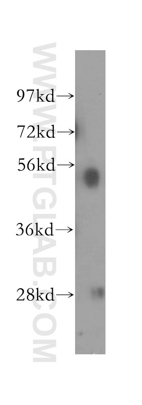 Western Blot (WB) analysis of human placenta tissue using NARF Polyclonal antibody (12173-1-AP)