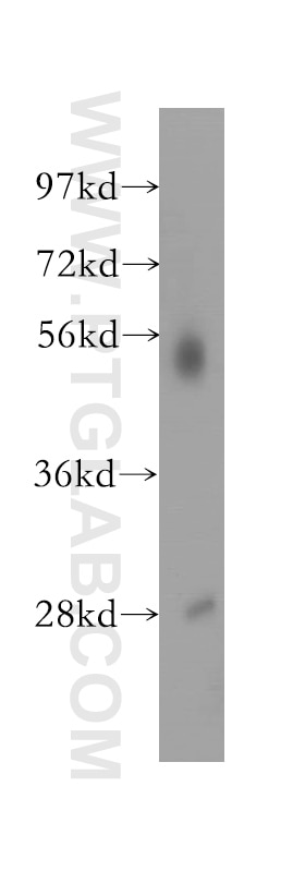 WB analysis of mouse testis using 12173-1-AP