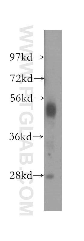 Western Blot (WB) analysis of human lung tissue using NARF Polyclonal antibody (12173-1-AP)