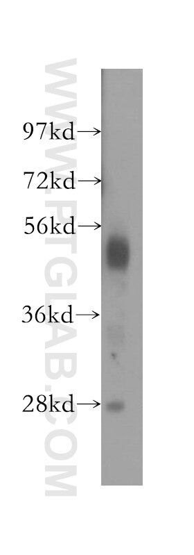 Western Blot (WB) analysis of human lung tissue using NARF Polyclonal antibody (12173-1-AP)