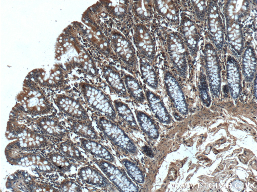 Immunohistochemistry (IHC) staining of human colon tissue using NARFL Polyclonal antibody (13652-1-AP)