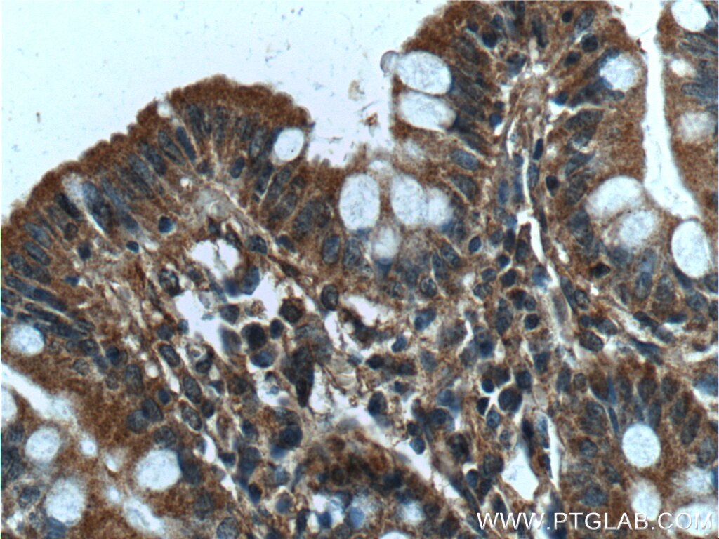 Immunohistochemistry (IHC) staining of human colon tissue using NARFL Polyclonal antibody (13652-1-AP)