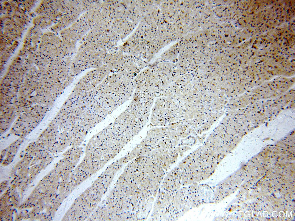 Immunohistochemistry (IHC) staining of human heart tissue using NARFL-Specific Polyclonal antibody (20209-1-AP)