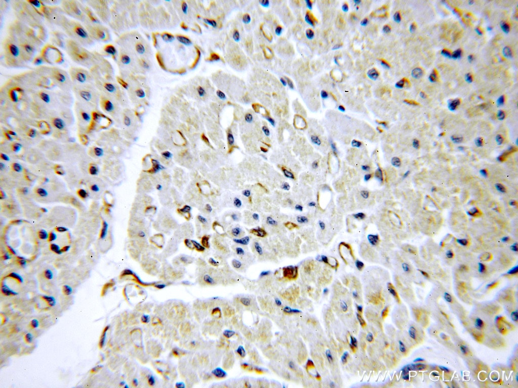 Immunohistochemistry (IHC) staining of human heart tissue using NARFL-Specific Polyclonal antibody (20209-1-AP)